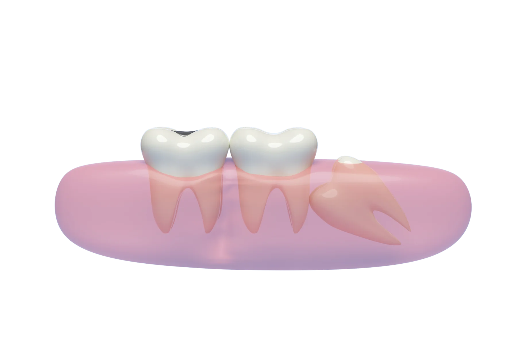 Tapping’s Trusted Emergency Dentist