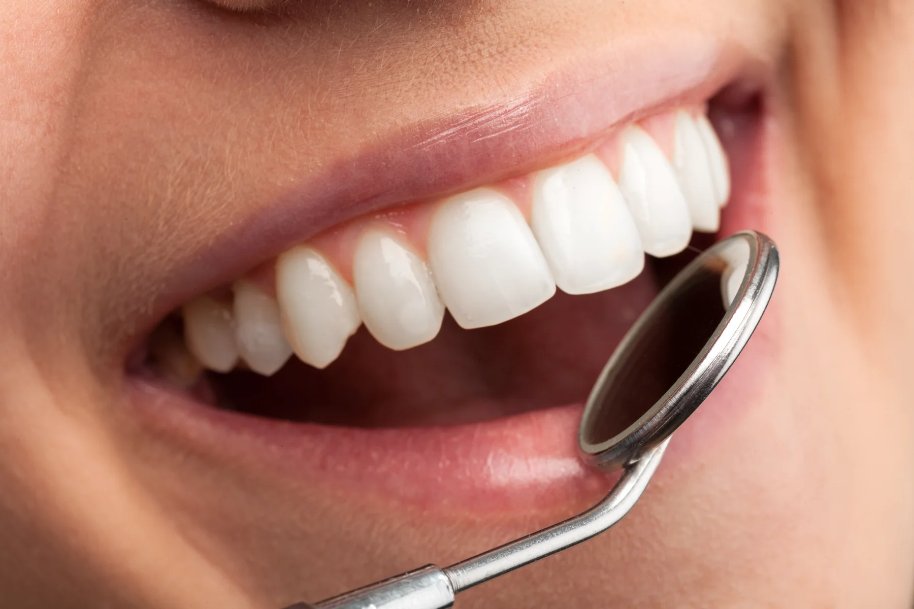High Dental Success with Mia Dental