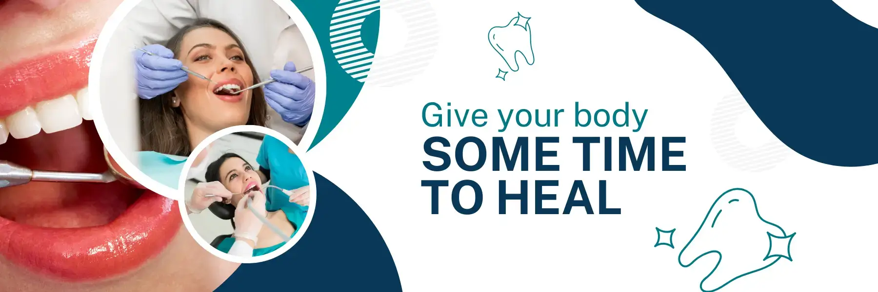 Give Your Body Time to Heal at Mia Dental