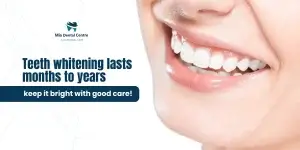 How long teeth whitening last